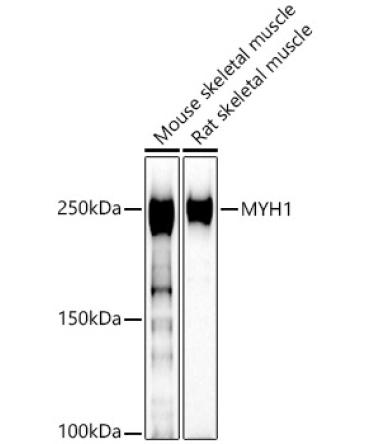 MYH1 Rabbit Polyclonal Antibody