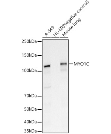 MYO1C Rabbit Polyclonal Antibody