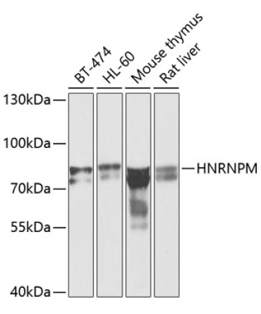 HNRNPM Rabbit Polyclonal Antibody