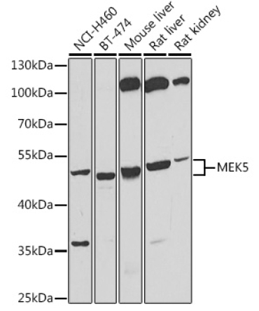 MEK5 Rabbit Polyclonal Antibody