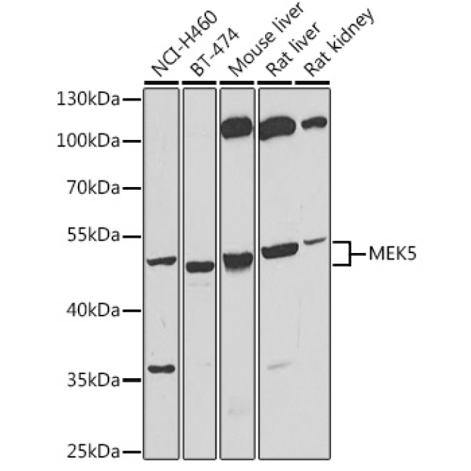 MEK5 Rabbit Polyclonal Antibody