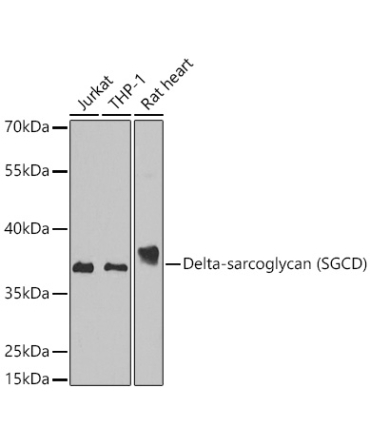 Delta-sarcoglycan (SGCD) Rabbit Polyclonal Antibody