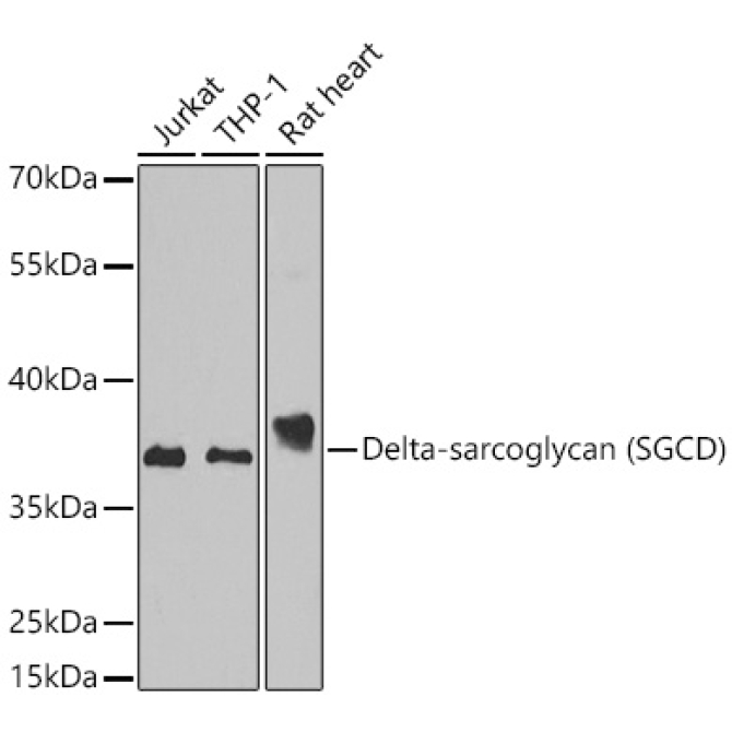 Delta-sarcoglycan (SGCD) Rabbit Polyclonal Antibody