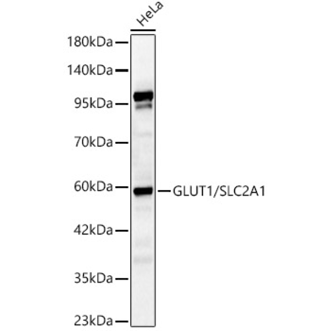 GLUT1/SLC2A1 Rabbit Polyclonal Antibody