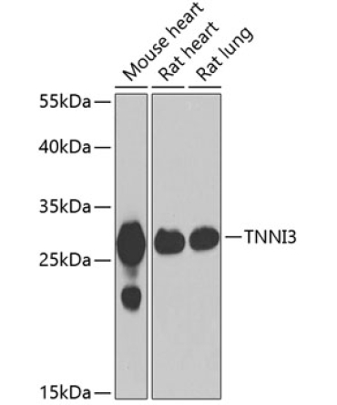 Cardiac Troponin I (TNNI3) Rabbit Polyclonal Antibody