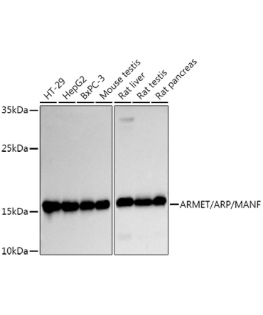 ARMET/ARP/MANF Rabbit Polyclonal Antibody