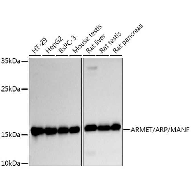 ARMET/ARP/MANF Rabbit Polyclonal Antibody