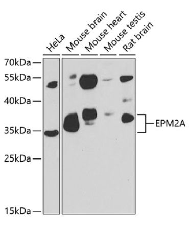 EPM2A Rabbit Polyclonal Antibody