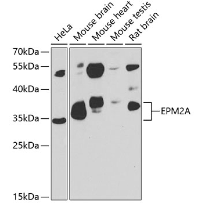 EPM2A Rabbit Polyclonal Antibody