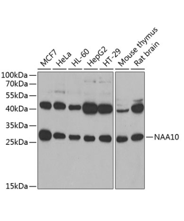 NAA10 Rabbit Polyclonal Antibody