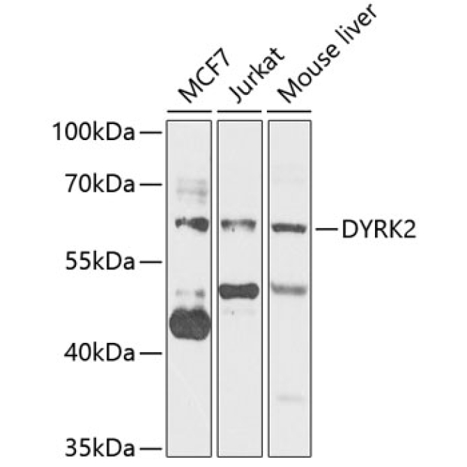 DYRK2 Rabbit Polyclonal Antibody