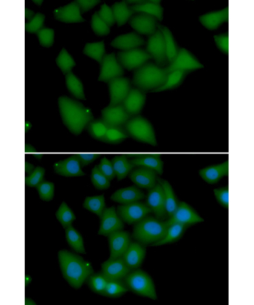 CaMKI Rabbit Polyclonal Antibody