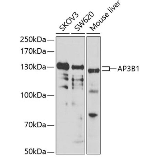 AP3B1 Rabbit Polyclonal Antibody
