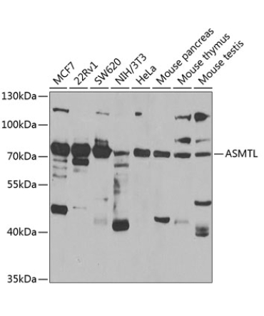 ASMTL Rabbit Polyclonal Antibody