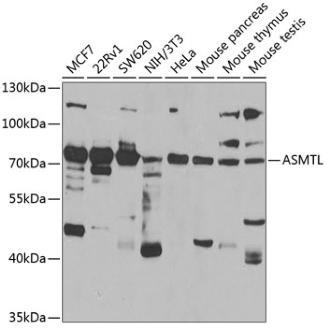 ASMTL Rabbit Polyclonal Antibody