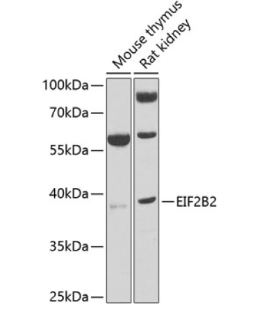 EIF2B2 Rabbit Polyclonal Antibody
