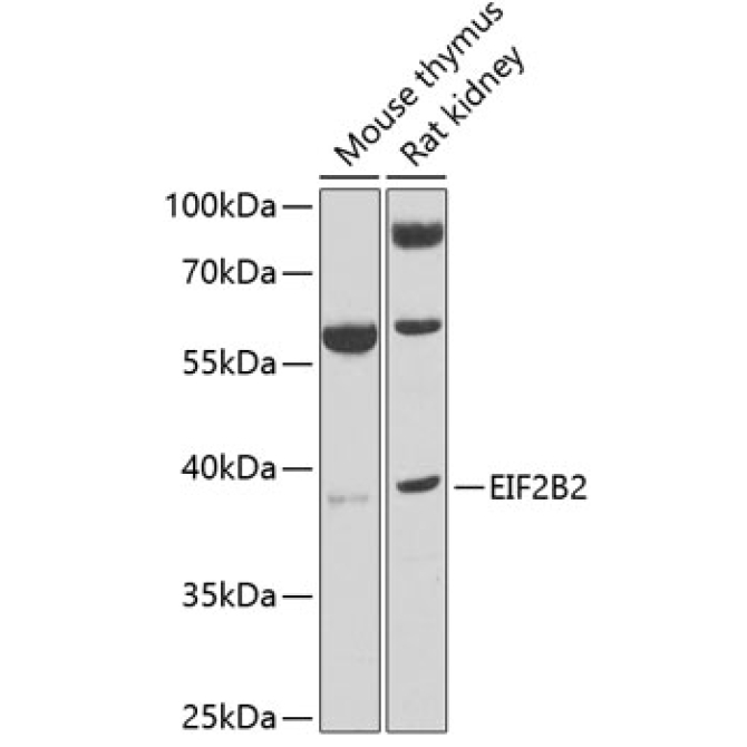 EIF2B2 Rabbit Polyclonal Antibody