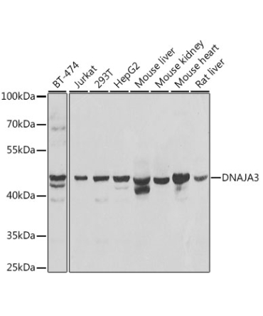 DNAJA3 Rabbit Polyclonal Antibody