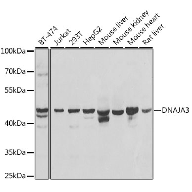 DNAJA3 Rabbit Polyclonal Antibody