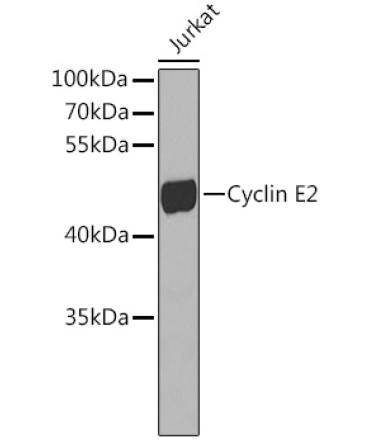 Cyclin E2 Rabbit Polyclonal Antibody