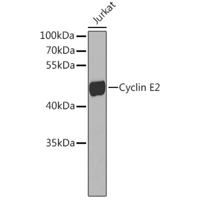 Cyclin E2 Rabbit Polyclonal Antibody