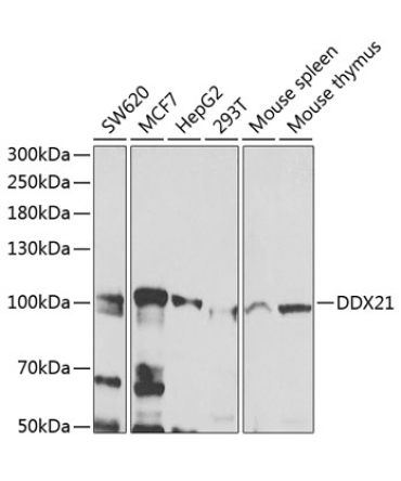 DDX21 Rabbit Polyclonal Antibody
