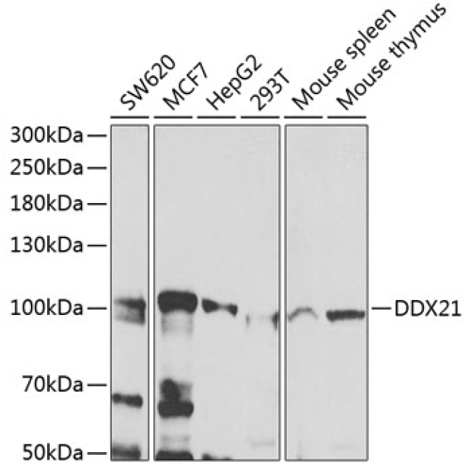 DDX21 Rabbit Polyclonal Antibody
