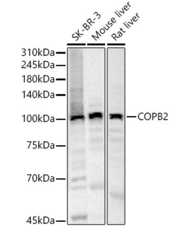 COPB2 Rabbit Polyclonal Antibody