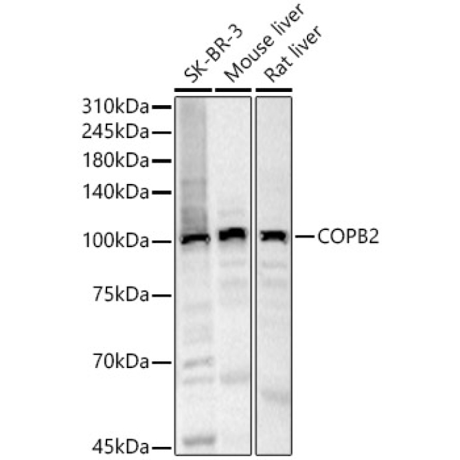 COPB2 Rabbit Polyclonal Antibody