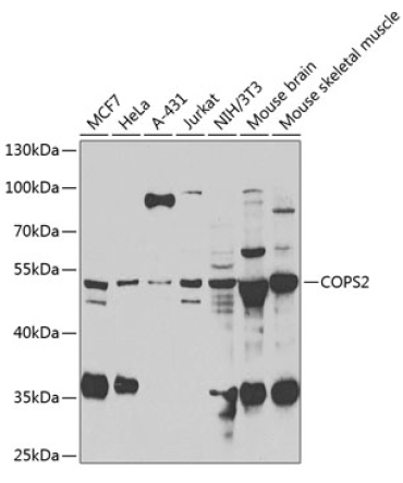 COPS2 Rabbit Polyclonal Antibody