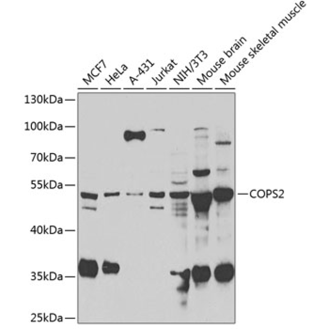 COPS2 Rabbit Polyclonal Antibody