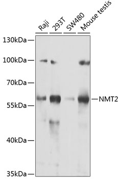 NMT2 Rabbit Polyclonal Antibody