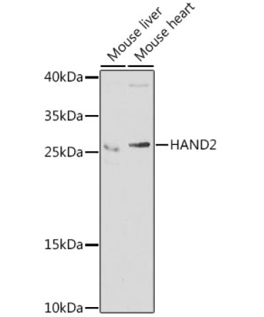 HAND2 Rabbit Polyclonal Antibody