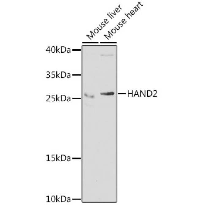 HAND2 Rabbit Polyclonal Antibody