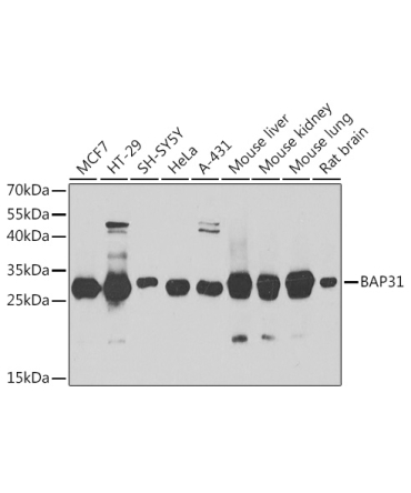 BAP31 Rabbit Polyclonal Antibody