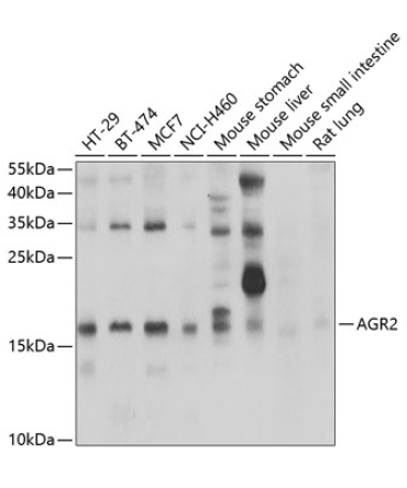 AGR2 Rabbit Polyclonal Antibody