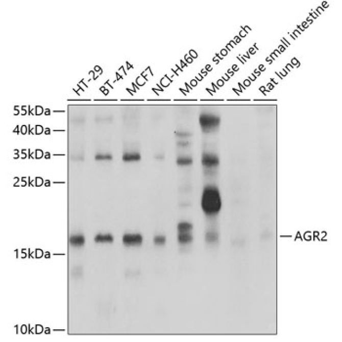 AGR2 Rabbit Polyclonal Antibody
