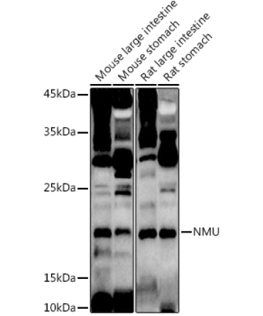 NMU Rabbit Polyclonal Antibody