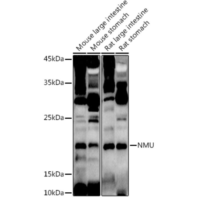 NMU Rabbit Polyclonal Antibody