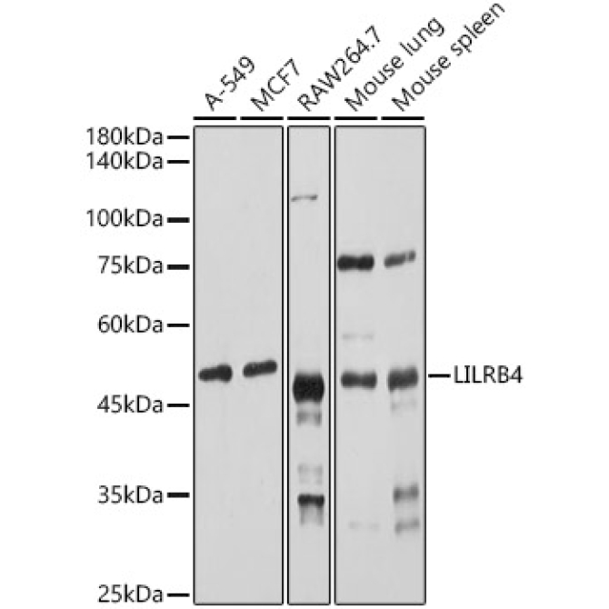 LILRB4 Rabbit Polyclonal Antibody