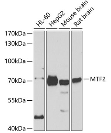 MTF2 Rabbit Polyclonal Antibody