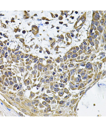 ICOSL Rabbit Polyclonal Antibody