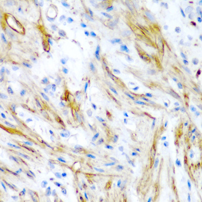 LMOD1 Rabbit Polyclonal Antibody