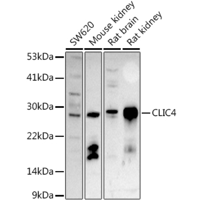 CLIC4 Rabbit Polyclonal Antibody
