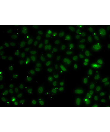 NSL1 Rabbit Polyclonal Antibody
