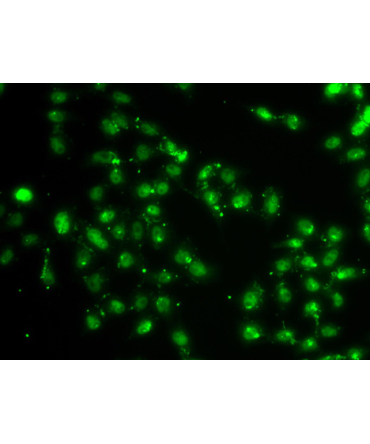 L3MBTL1 Rabbit Polyclonal Antibody