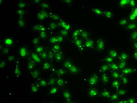 L3MBTL1 Rabbit Polyclonal Antibody