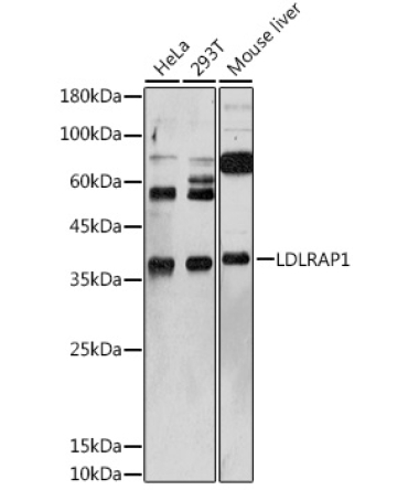 LDLRAP1 Rabbit Polyclonal Antibody