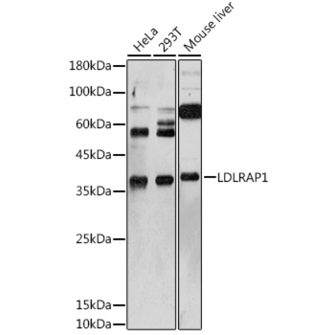 LDLRAP1 Rabbit Polyclonal Antibody