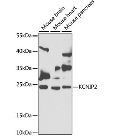 KCNIP2 Rabbit Polyclonal Antibody